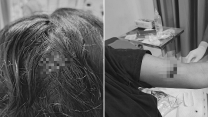 aniaya-anak-tiri-temannya-pria-ini-dicari-polisi