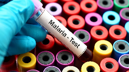 dinkes-mimika-target-1-juta-testing-malaria-tahun-ini
