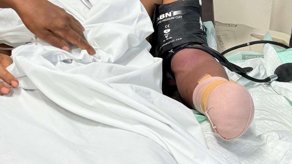 kena-begal-di-jalan-bougenville-tangan-pemuda-ini-putus