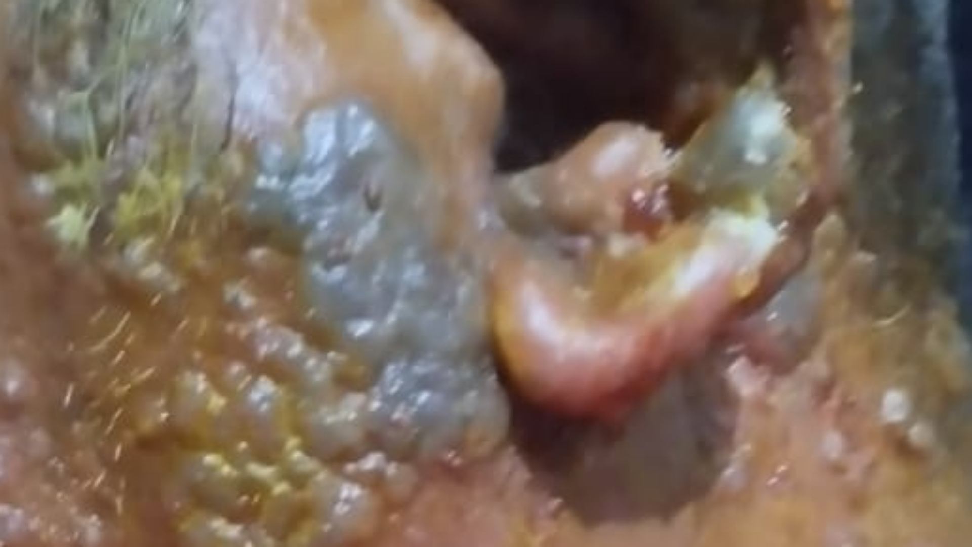 Foto warga yang tersebar di medsos dan disebut menderita cacar monyet.