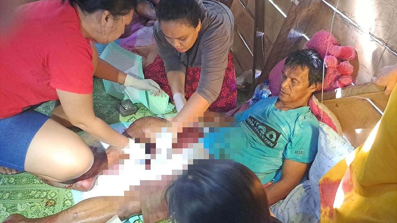 kontak-senjata-di-paniai-seorang-polisi-dan-warga-sipil-kena-tembak