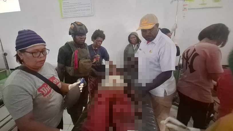 Anak yang jadi korban baku tembak aparat gabungan TNI-Polri dengan TPNPB), Senin (8/4/2024) siang. Foto: Istimewa