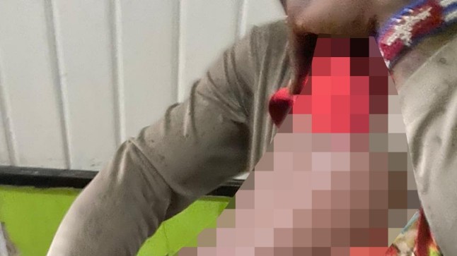 anak-korban-rekoset-aparat-di-intan-jaya-dirujuk-ke-nabire